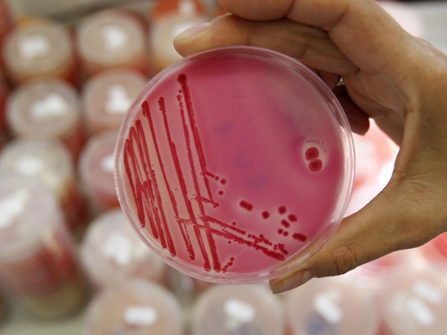 Salmonella Testing: Ensuring Food Safety Through Microbiological Analysis